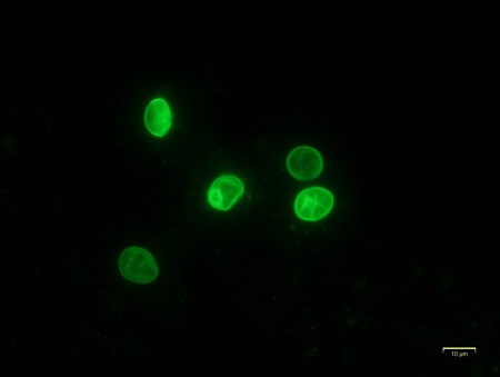 水の中の病原微生物を追いかける